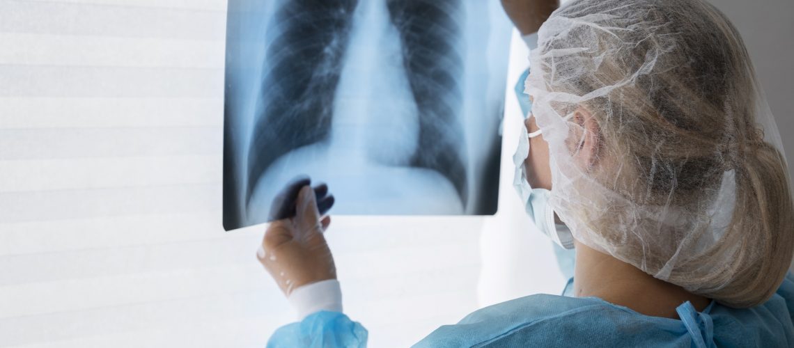 side-view-doctor-checking-radiography